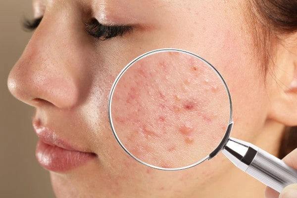 ārsts dermatologs venerologs